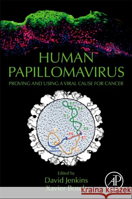 Human Papillomavirus: Proving and Using a Viral Cause for Cancer Xavier Bosch David Jenkins 9780128144572 Academic Press - książka