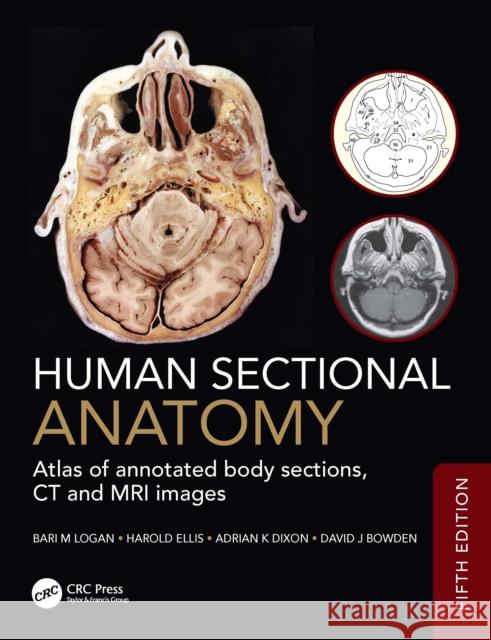 Human Sectional Anatomy: Atlas of annotated body sections, CT and MRI images David J (Abdominal Imaging Fellow, Department of Medical Imaging Sunnybrook Health Sciences Centre, Toronto, Canada and 9781041142744 CRC Press - książka
