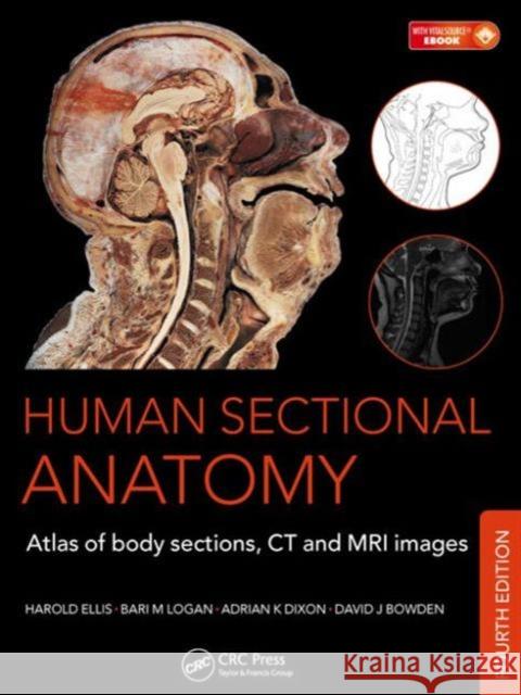 Human Sectional Anatomy: Atlas of Body Sections, CT and MRI Images, Fourth Edition Dixon, Adrian K. 9781498703604 CRC Press - książka