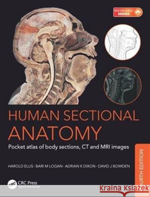 Human Sectional Anatomy: Pocket Atlas of Body Sections, CT and MRI Images, Fourth Edition Ellis Harold Logan Bari M. Dixon Adrian K. 9781498708548 Taylor & Francis Inc - książka