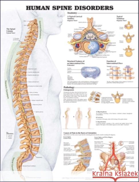 Human Spine Disorders Anatomical Chart   9781587793998  - książka