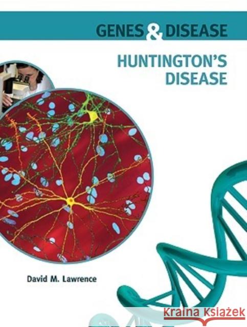 Huntington's Disease David M Lawrence 9780791095867 Chelsea House Publishers - książka