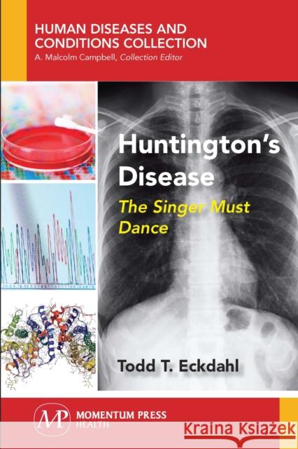 Huntington's Disease: The Singer Must Dance Todd T. Eckdahl 9781944749651 Momentum Press - książka