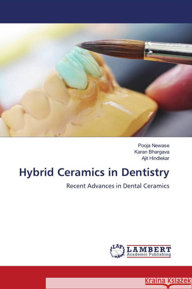 Hybrid Ceramics in Dentistry Newase, Pooja, Bhargava, Karan, Hindlekar, Ajit 9786206183679 LAP Lambert Academic Publishing - książka