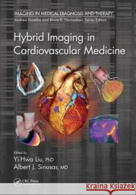 Hybrid Imaging in Cardiovascular Medicine Yi-Hwa Liu Albert J. Sinusas 9781466595378 Taylor & Francis Group - książka