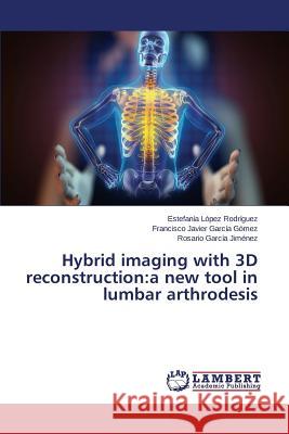 Hybrid imaging with 3D reconstruction: a new tool in lumbar arthrodesis López Rodríguez Estefanía, García Gómez Francisco Javier, García Jiménez Rosario 9783659789342 LAP Lambert Academic Publishing - książka