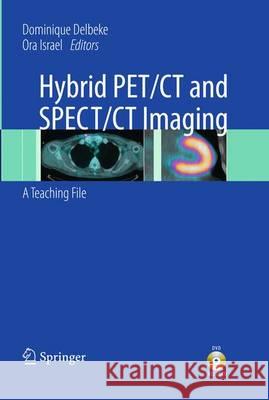 Hybrid Pet/CT and Spect/CT Imaging: A Teaching File Delbeke, Dominique 9781461400905 Not Avail - książka