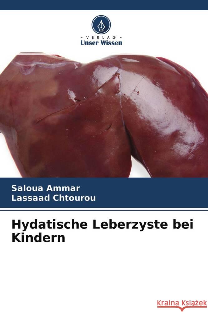 Hydatische Leberzyste bei Kindern Ammar, Saloua, Chtourou, Lassaad 9786204658193 Verlag Unser Wissen - książka