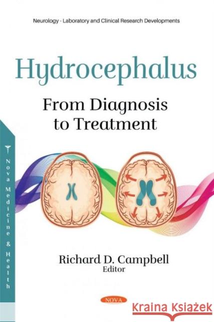 Hydrocephalus: From Diagnosis to Treatment Richard D. Campbell   9781536196207 Nova Science Publishers Inc - książka