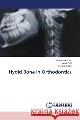 Hyoid Bone in Orthodontics Prashant Kumar Amol Patil Veera Bhosale 9786203583267 LAP Lambert Academic Publishing - książka