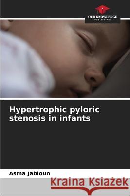 Hypertrophic pyloric stenosis in infants Asma Jabloun 9786209428548 Our Knowledge Publishing - książka