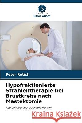 Hypofraktionierte Strahlentherapie bei Brustkrebs nach Mastektomie Peter Rotich 9786205752647 Verlag Unser Wissen - książka