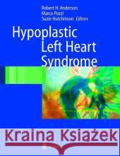 Hypoplastic Left Heart Syndrome Robert Henry Anderson R. H. Anderson M. Pozzi 9781852337650 Springer - książka