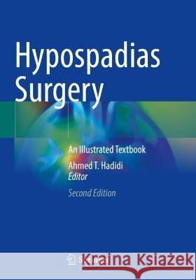 Hypospadias Surgery  9783030942502 Springer International Publishing - książka