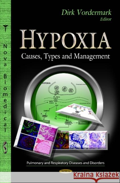 Hypoxia: Causes, Types & Management Dirk Vordermark 9781620817698 Nova Science Publishers Inc - książka