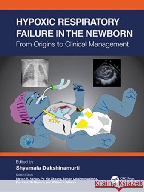 Hypoxic Respiratory Failure in the Newborn: From Origins to Clinical Management Shyamala Dakshinamurti 9781032078182 CRC Press - książka