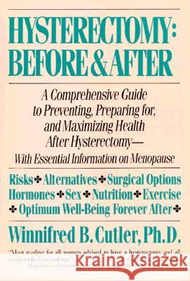 Hysterectomy Before & After: A Comprehensive Guide to Preventing, Preparing For, and Maximizing Health Winnifred B. Cutler Cutler 9780060916299 HarperCollins Publishers - książka