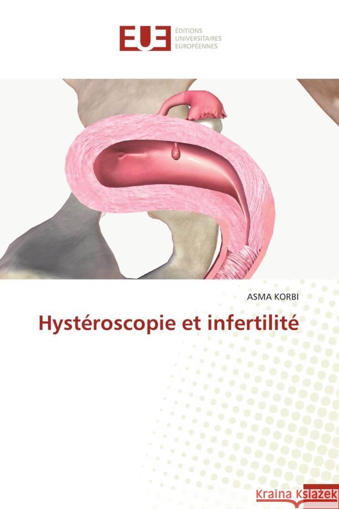 Hystéroscopie et infertilité KORBI, ASMA 9786206722885 Éditions universitaires européennes - książka