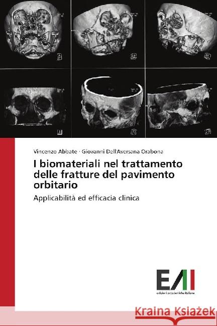 I biomateriali nel trattamento delle fratture del pavimento orbitario : Applicabilità ed efficacia clinica Abbate, Vincenzo 9783330780552 Edizioni Accademiche Italiane - książka