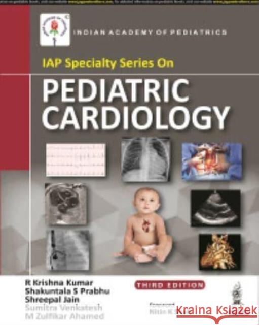 IAP Specialty Series on Pediatric Cardiology R Krishna Kumar, Shakuntala S Prabhu, Shreepal Jain, Sumitra Venkatesh, M Zulfikar Ahamed 9789390595143 Jaypee Brothers Medical Publishers - książka