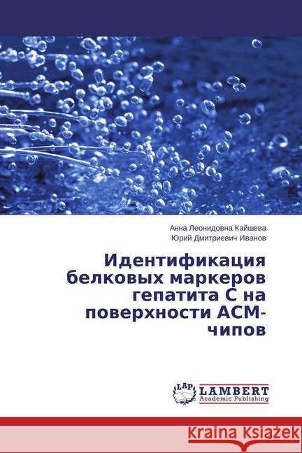 Identifikaciya belkovyh markerov gepatita S na poverhnosti ASM-chipov Kajsheva, Anna Leonidovna; Ivanov, Jurij Dmitrievich 9783659716959 LAP Lambert Academic Publishing - książka