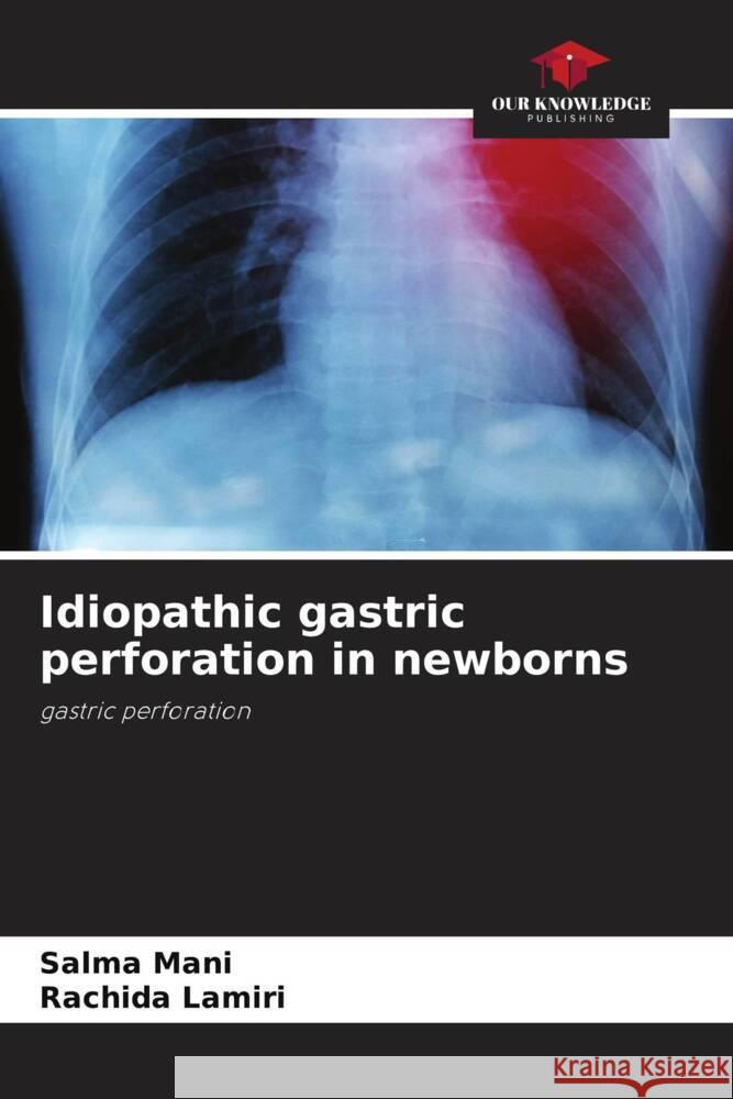 Idiopathic gastric perforation in newborns Salma Mani Rachida Lamiri 9786207402694 Our Knowledge Publishing - książka