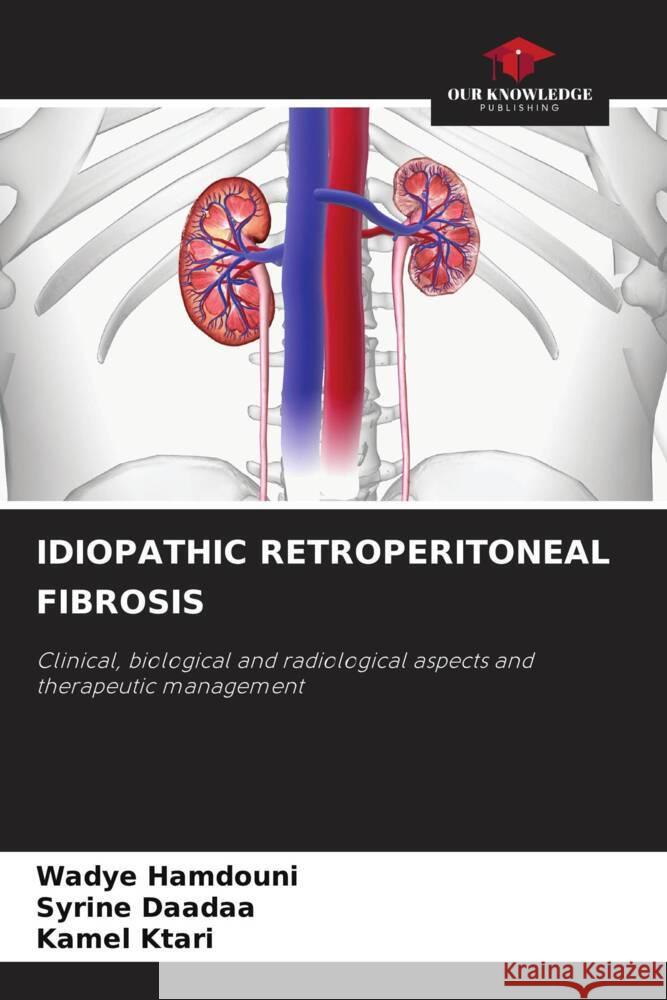 IDIOPATHIC RETROPERITONEAL FIBROSIS HAMDOUNI, WADYE, Daadaa, Syrine, Ktari, Kamel 9786203002232 Our Knowledge Publishing - książka