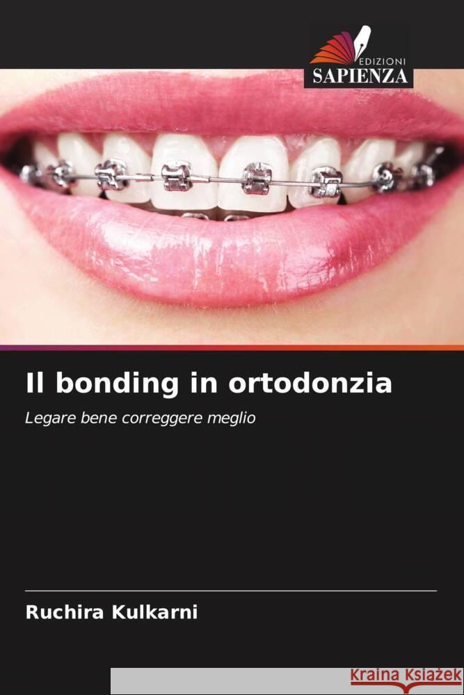 Il bonding in ortodonzia Kulkarni, Ruchira 9786205446584 Edizioni Sapienza - książka