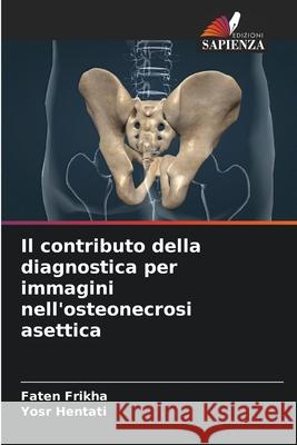 Il contributo della diagnostica per immagini nell'osteonecrosi asettica Frikha, Faten, Hentati, Yosr 9786202325363 Edizioni Sapienza - książka