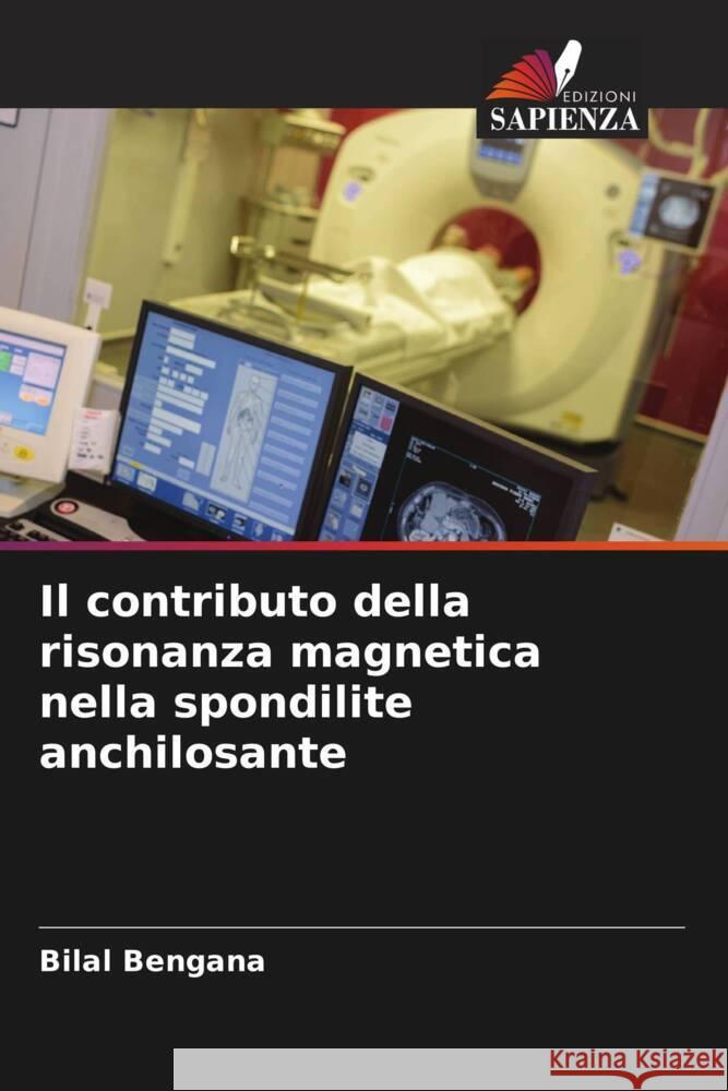 Il contributo della risonanza magnetica nella spondilite anchilosante Bengana, Bilal 9786207115624 Edizioni Sapienza - książka