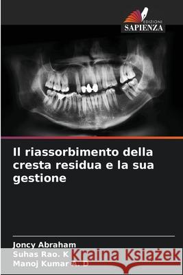 Il riassorbimento della cresta residua e la sua gestione Joncy Abraham Suhas Ra Manoj Kuma 9786204130408 Edizioni Sapienza - książka