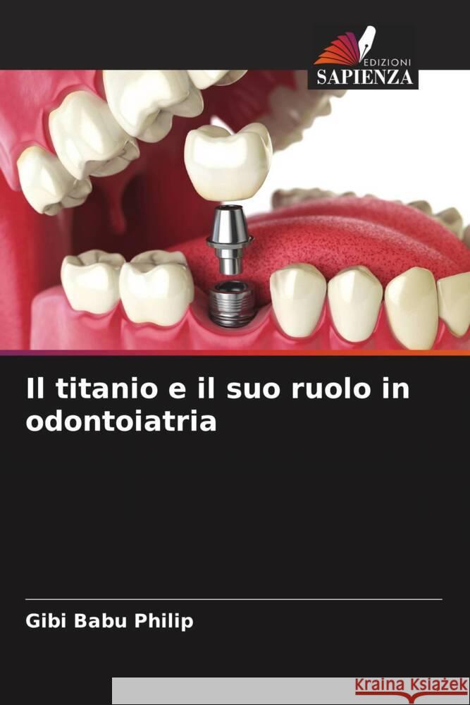 Il titanio e il suo ruolo in odontoiatria Philip, Gibi Babu 9786205572580 Edizioni Sapienza - książka