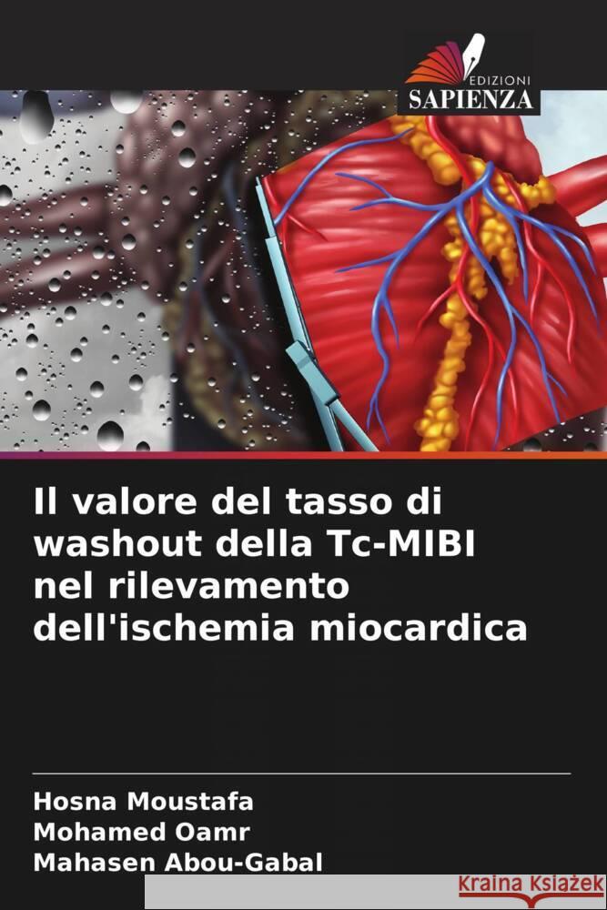 Il valore del tasso di washout della Tc-MIBI nel rilevamento dell'ischemia miocardica Hosna Moustafa Mohamed Oamr Mahasen Abou-Gabal 9786206903024 Edizioni Sapienza - książka