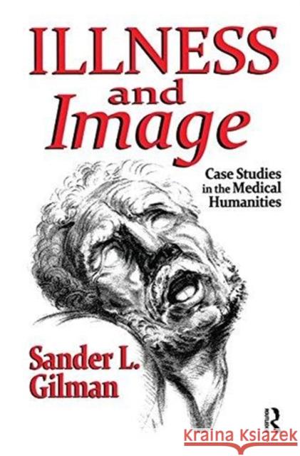 Illness and Image: Case Studies in the Medical Humanities Sander L. Gilman 9781138510791 Routledge - książka