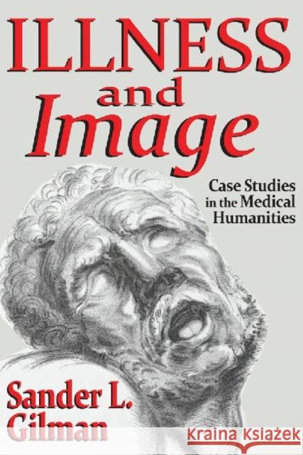 Illness and Image: Case Studies in the Medical Humanities Gilman, Sander L. 9781412854931 Transaction Publishers - książka