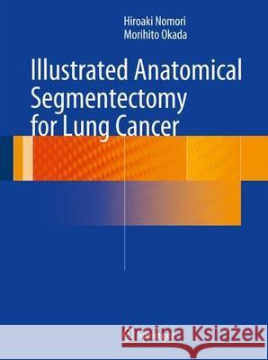 Illustrated Anatomical Segmentectomy for Lung Cancer Hiroaki Nomori Morihito Okada 9784431541431 Springer - książka