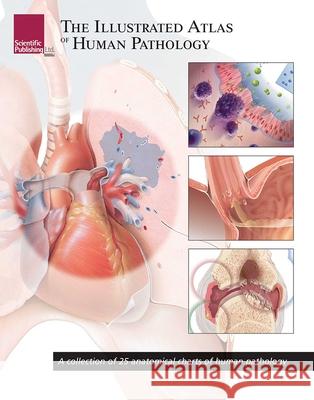 Illustrated Atlas of Human Pathology: A Collection of 25 Anatomical Charts of Human Pathology Scientific Publishing 9781932922998 Scientific Publishing - książka