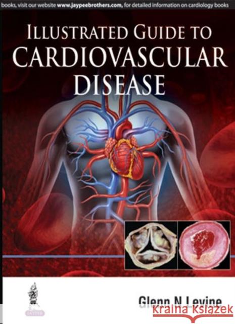 Illustrated Guide to Cardiovascular Disease Glenn N. Levine 9789351528449 Jaypee Brothers, Medical Publishers Pvt. Ltd. - książka