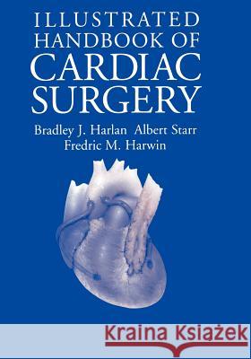 Illustrated Handbook of Cardiac Surgery Bradley J. Harlan Frederick M. Harwin Albert Starr 9780387944470 Springer - książka