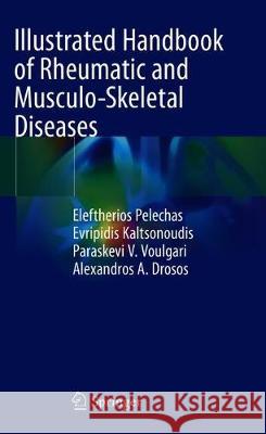 Illustrated Handbook of Rheumatic and Musculo-Skeletal Diseases Eleftherios Pelechas Evripidis Kaltsonoudis Paraskevi V. Voulgari 9783030036638 Springer - książka