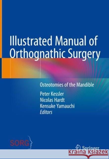 Illustrated Manual of Orthognathic Surgery: Osteotomies of the Mandible  9783031069772 Springer International Publishing AG - książka