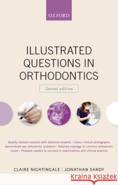 Illustrated Questions in Orthodontics Claire Nightingale Jonathan Sandy 9780198714828 Oxford University Press, USA - książka