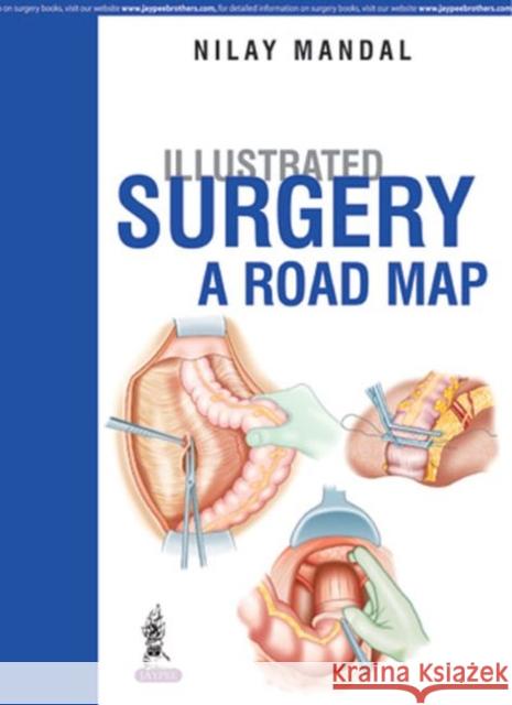 Illustrated Surgery - A Road Map Nilay Mandal 9789385891205 Jaypee Brothers, Medical Publishers Pvt. Ltd. - książka