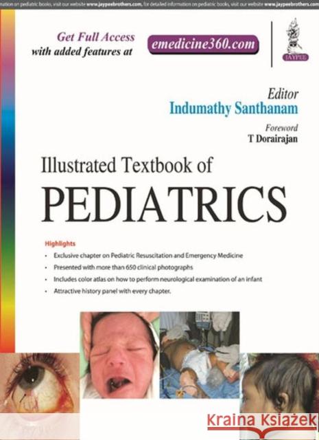 Illustrated Textbook of Pediatrics Indumathy Santhanam 9789352701025 Jp Medical Ltd - książka