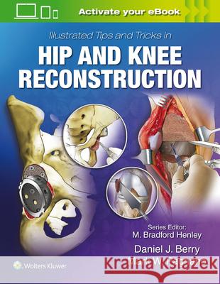 Illustrated Tips and Tricks in Hip and Knee Reconstructive and Replacement Surgery Daniel J. Berry Mark W. Pagnano 9781496392060 LWW - książka