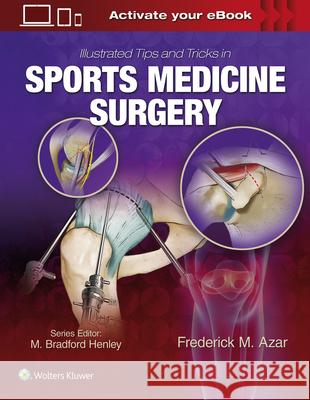 Illustrated Tips and Tricks in Sports Medicine Surgery Frederick Azar 9781496375414 LWW - książka