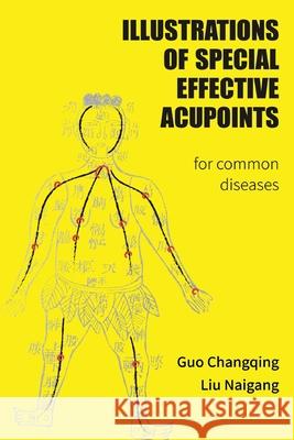 Illustrations Of Special Effective Acupoints for common Diseases Changqing Guo 9780648921592 Heartspace Publications - książka