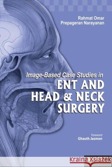 Image-Based Case Studies in ENT and Head & Neck Surgery Rahmat Omar 9789350900895  - książka