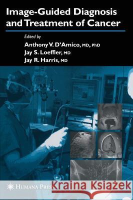 Image-Guided Diagnosis and Treatment of Cancer Anthony V. D'Amico Jay S. Loeffler Jay R. Harris 9781588291141 Humana Press - książka