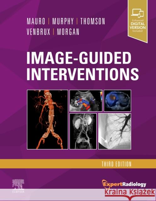 Image-Guided Interventions: Expert Radiology Series Matthew A. Mauro Kieran P. J. Murphy Kenneth R. Thomson 9780323612043 Saunders - książka